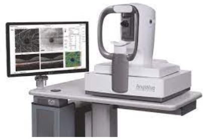 Angiografia-OCT o Angio-OCT o angiografia a coerenza ottica